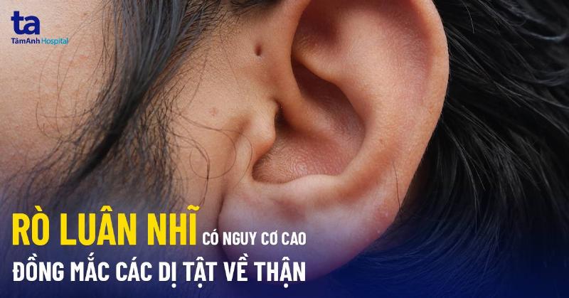 Minh họa các phương pháp điều trị cục u vành tai, bao gồm chườm ấm, dẫn lưu và phẫu thuật nhỏ