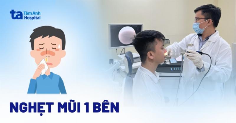 Dấu hiệu cảnh báo khi bị đau họng cần đi khám bác sĩ ngay