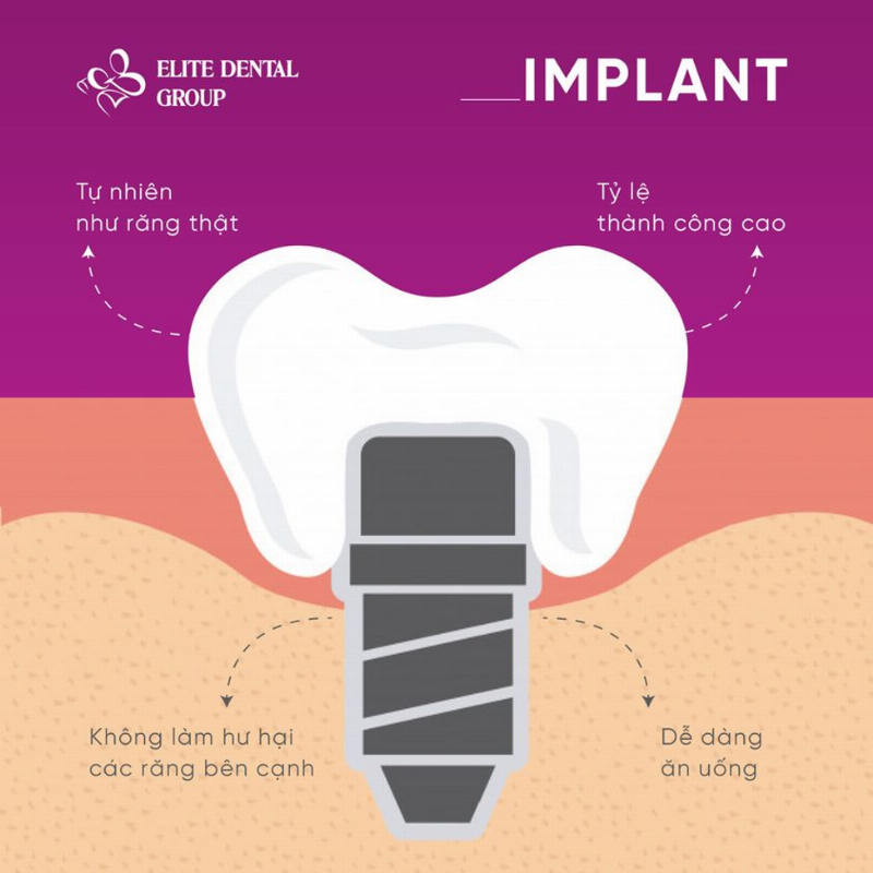 Biến chứng trồng răng implant