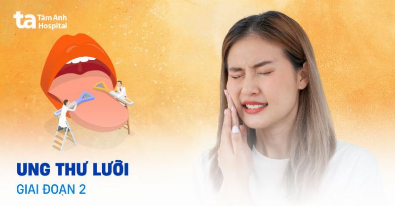 Hình ảnh bác sĩ nha khoa đang kiểm tra lưỡi của bệnh nhân