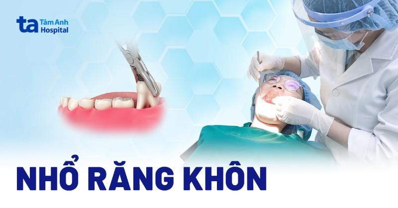 Nhổ răng khôn an toàn và hiệu quả