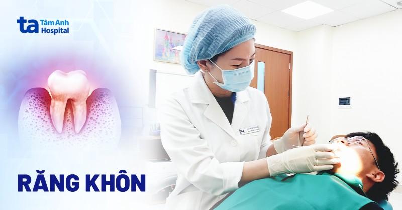 Vị trí răng khôn trong hàm