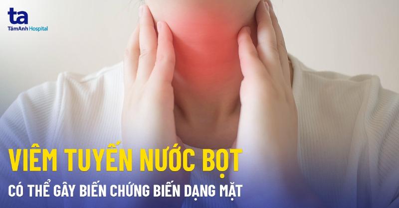 Viêm nhiễm tuyến nước bọt