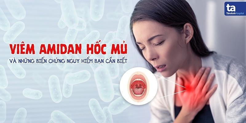 Áp xe quanh amidan gây đau họng nặng