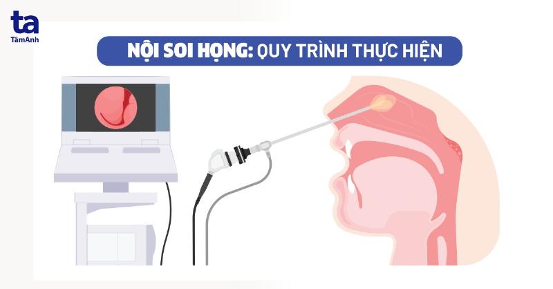 Hình ảnh bác sĩ kiểm tra họng