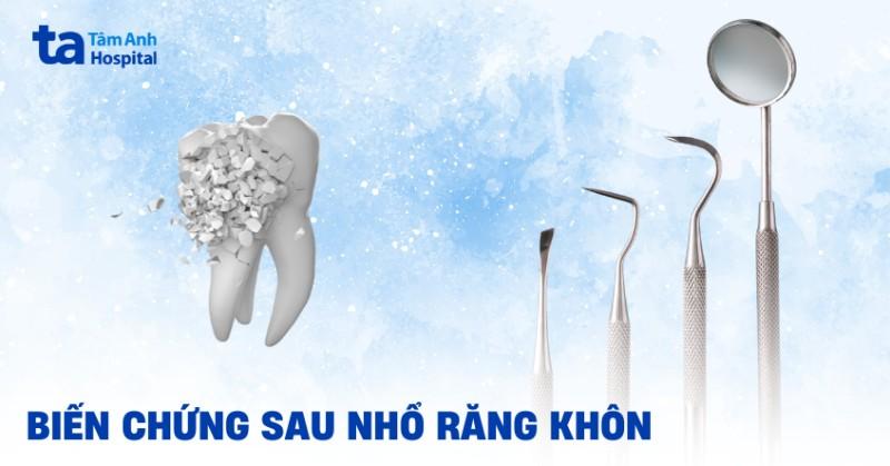 Biến chứng sau nhổ răng khôn