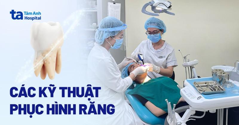 Phương pháp phục hình răng