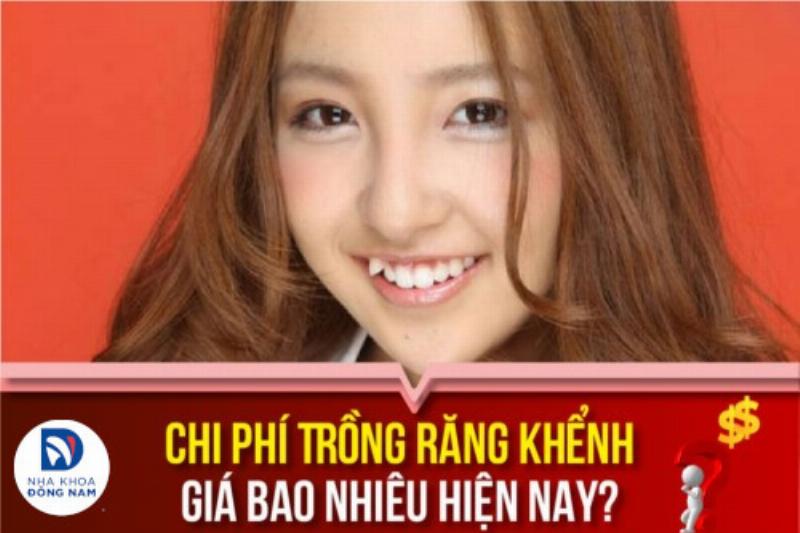 Trồng Răng Khểnh Giá Bao Nhiêu?