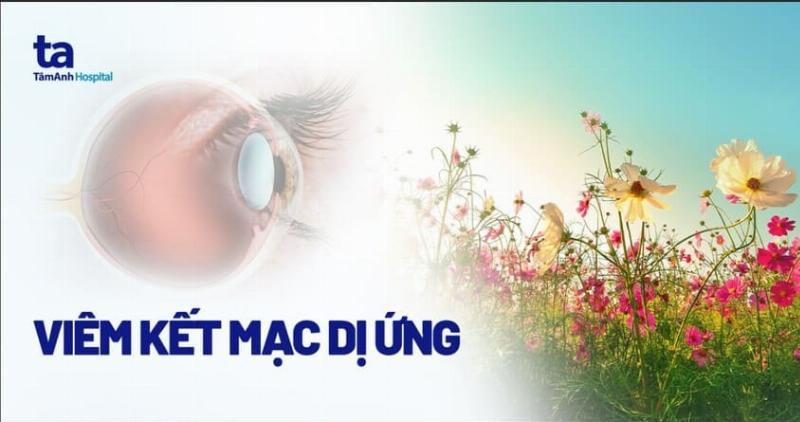 Biện pháp phòng ngừa viêm kết mạc dị ứng