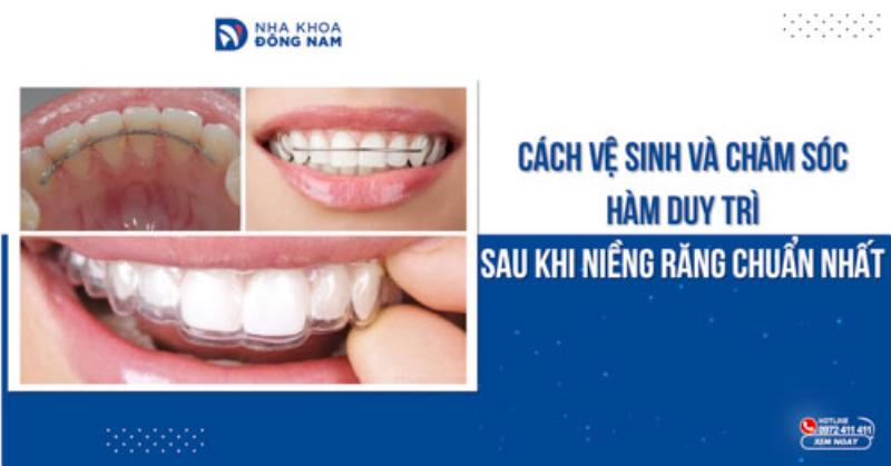 Hàm Duy Trì Sau Niềng: Bước Cuối Cho Nụ Cười Hoàn Hảo