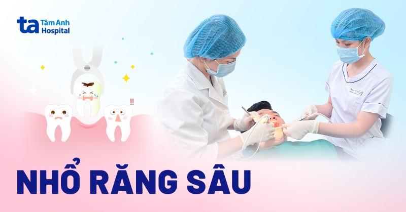 Cảm giác nhổ răng sâu là gì?