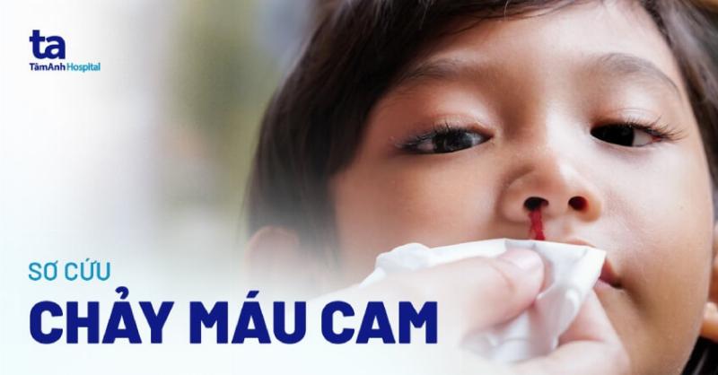 Cầm máu cam nhanh chóng và hiệu quả