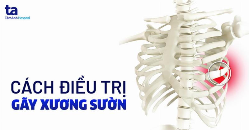 Gãy Xương Sườn Bao Lâu Mới Lành?