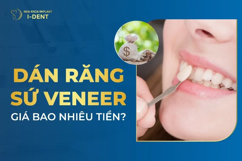 Trồng Răng Giả Giá Bao Nhiêu?