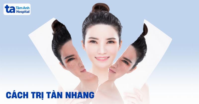 Điều trị tàn nhang