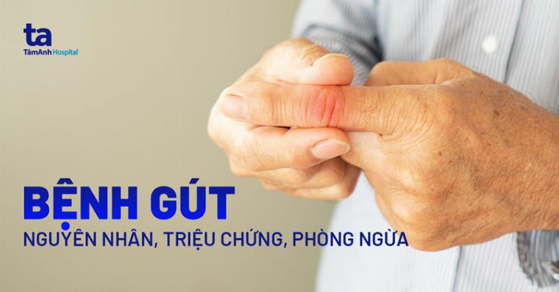 Điều Trị Viêm Khớp Ngón Chân Cái: Thuốc và Thay Đổi Lối Sống