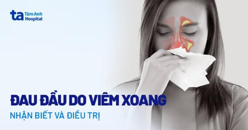 Viêm Xoang Gây Đau Đầu: Nguyên Nhân, Triệu Chứng và Cách Điều Trị