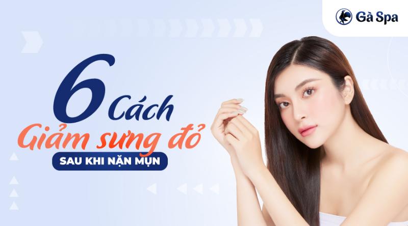 Nặn Mụn Xong Nên Làm Gì Để Không Bị Sưng?