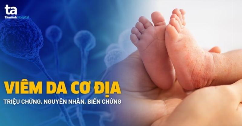 Hiểu Rõ Về Hình Ảnh Viêm Da Dị Ứng