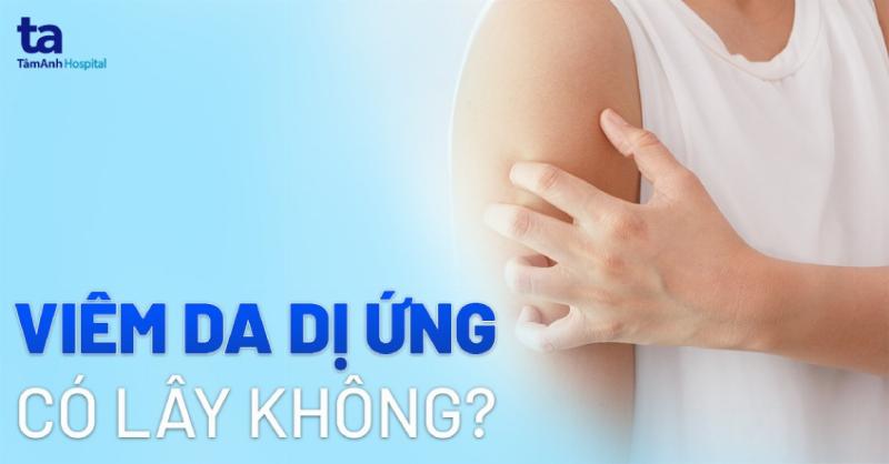 Hình ảnh viêm da dị ứng thuyên giảm