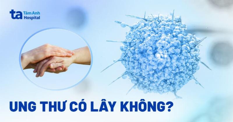 Ung Thư Gan Có Lây Không? Sự Thật Bạn Cần Biết