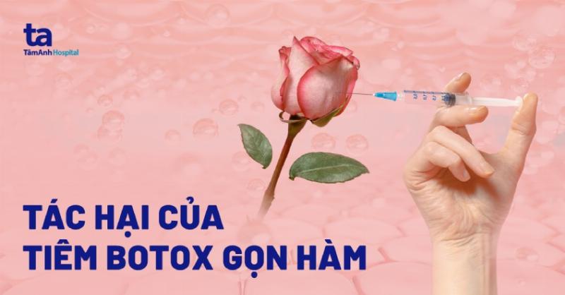 Lợi ích của tiêm Botox gọn hàm