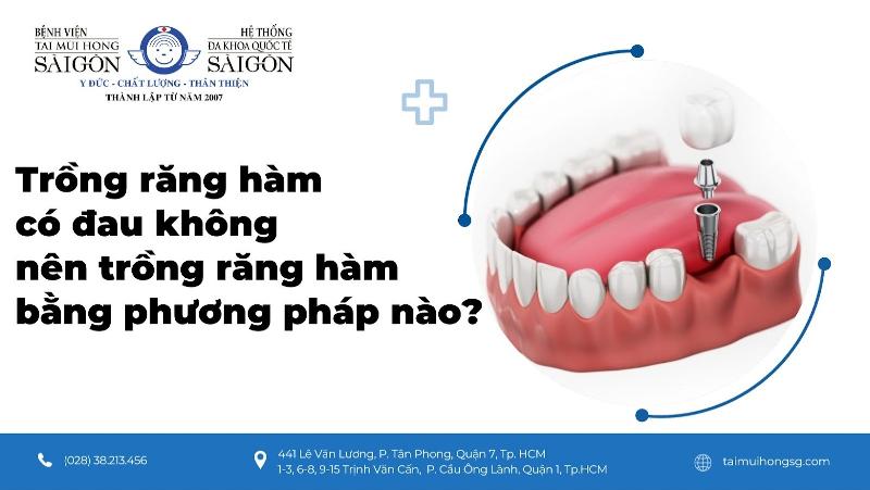 Lựa chọn phương pháp trồng răng