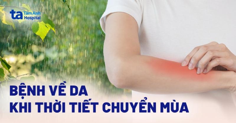 Mụn dị ứng thời tiết điều trị