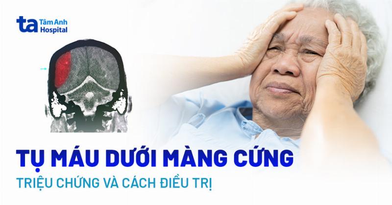 Các nguyên nhân dẫn đến tụ máu ngoài màng cứng