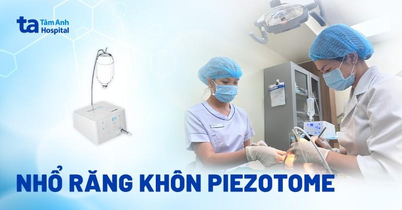 Cách Nhổ Răng Không Đau: Bí Quyết Cho Nụ Cười Tự Tin