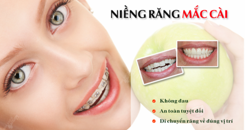 Nha Khoa Răng Hàm Mặt Sài Gòn: Lựa Chọn Tốt Nhất Cho Nụ Cười Rạng Rỡ