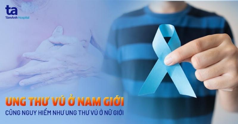 Phòng ngừa ung thư vú nam giới