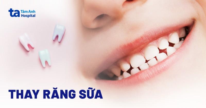 Thay Răng Sữa Bao Lâu Thì Mọc?