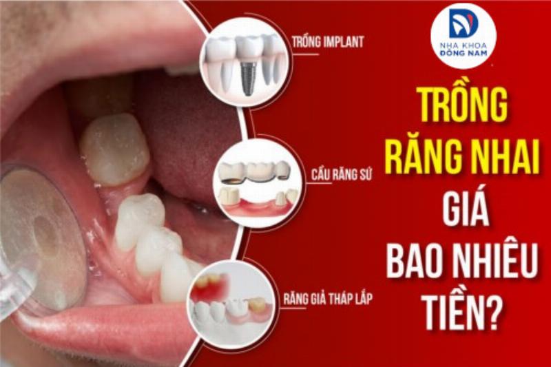 Sơ đồ minh họa quy trình trồng răng hàm giả tháo lắp tại nha khoa.