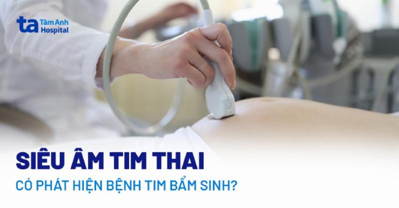 Siêu âm tim thai