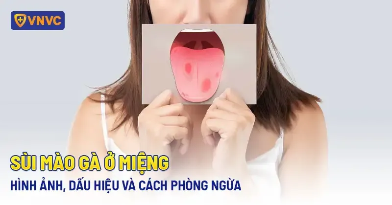 Sùi Mào Gà Ở Miệng Có Đau Không?