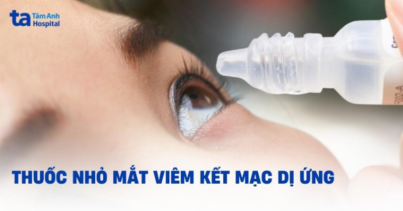 Các loại thuốc nhỏ mắt viêm kết mạc dị ứng phổ biến