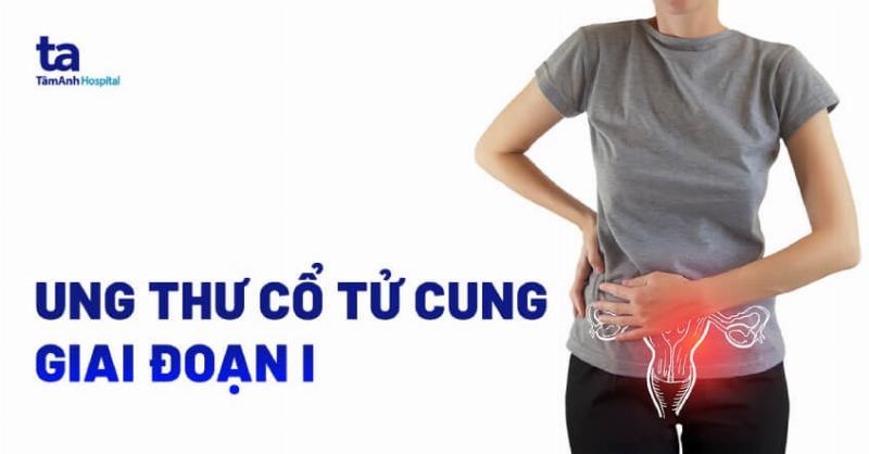 Triệu chứng Ung thư cổ tử cung giai đoạn muộn