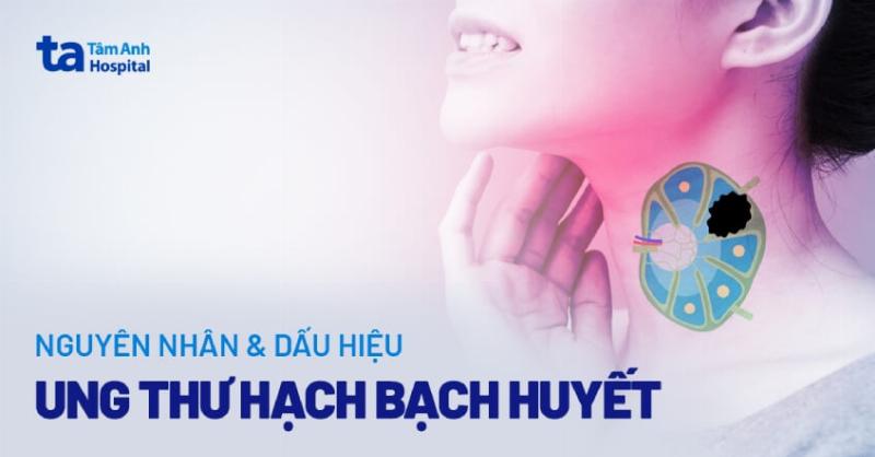 Các Triệu Chứng Của Ung Thư Hạch Bạch Huyết