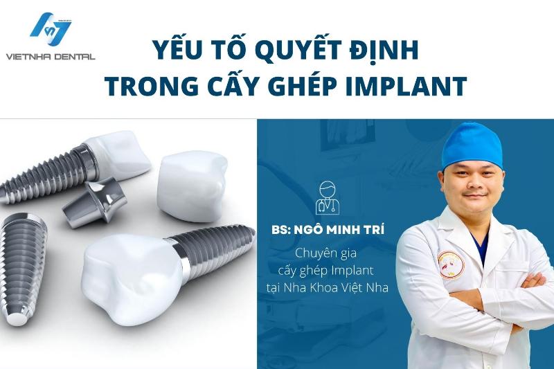 Tay nghề bác sĩ trồng răng