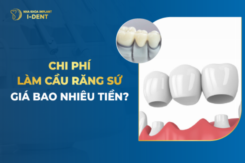 Hình ảnh trồng răng giả cầu răng