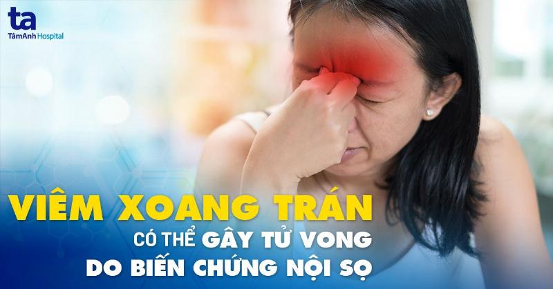 Xông mũi viêm xoang trán