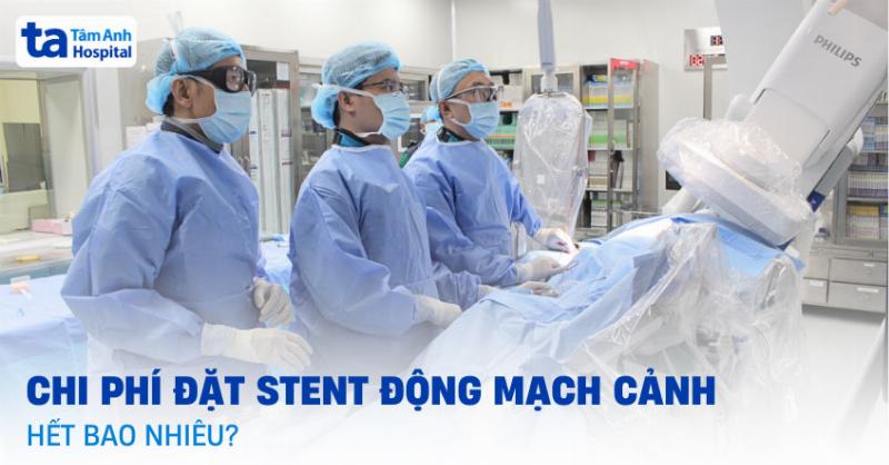 Chi phí đặt stent mạch máu não tại bệnh viện