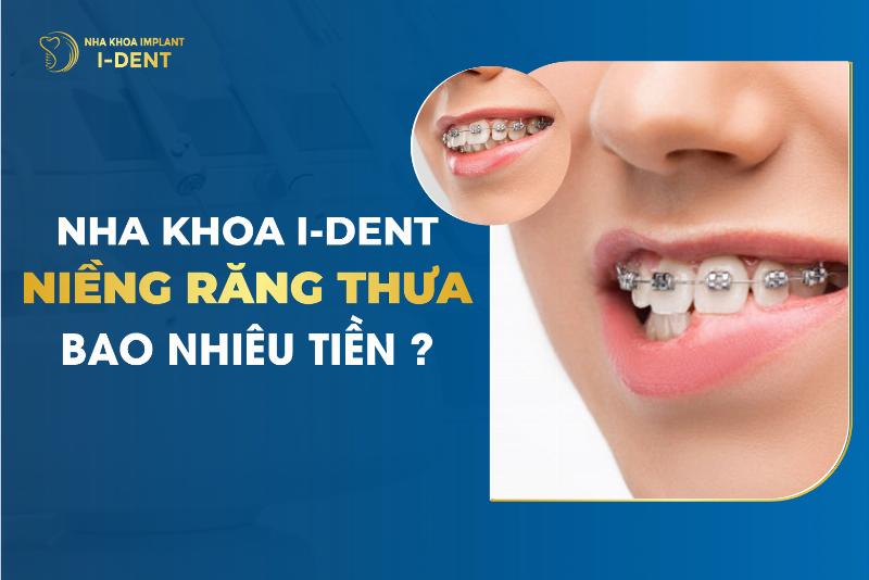 Niềng Răng Bao Nhiêu Tiền 1 Hàm?