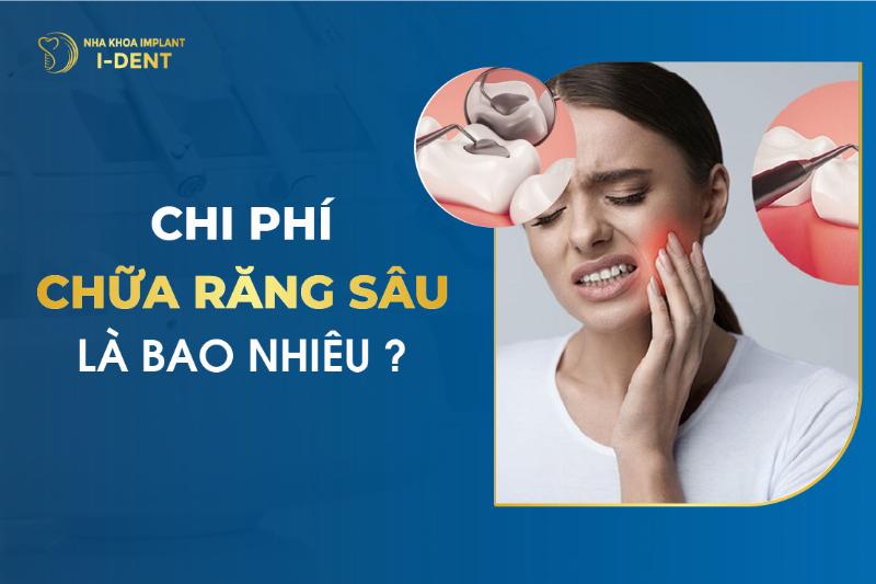 Ảnh hưởng của cơ sở nha khoa đến chi phí trồng răng