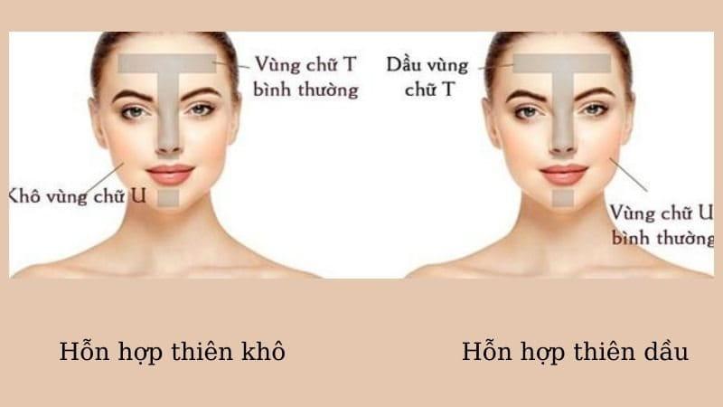 Đặc điểm da hỗn hợp thiên dầu