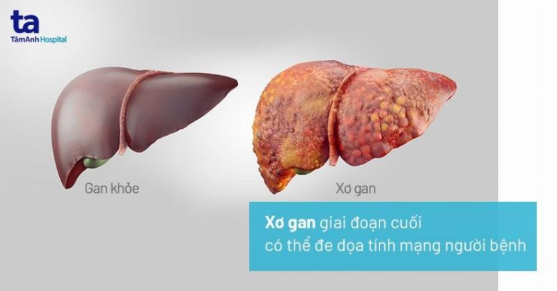 Hình ảnh minh họa đau bụng kinh và các vấn đề sức khỏe khác