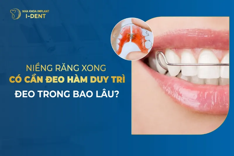 Niềng Răng Xong Đeo Hàm Duy Trì Bao Lâu?