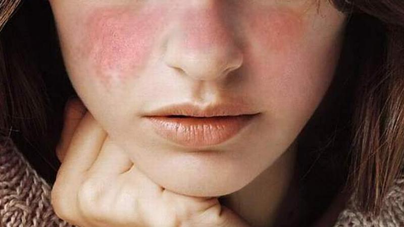 Đắp Mặt Nạ Giấy Bao Nhiêu Phút Là Đủ? Lời Khuyên Từ Nha Sĩ