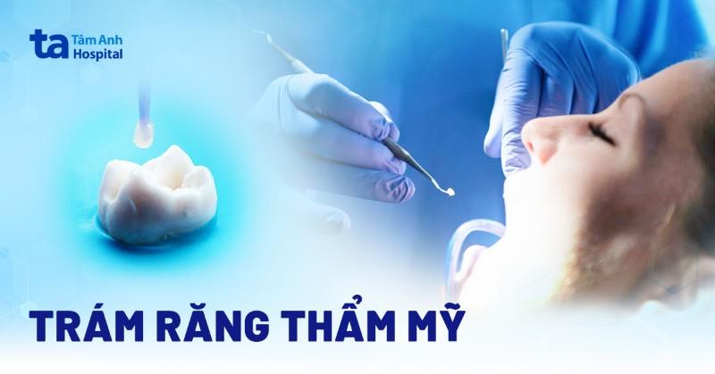 Thẩm Mỹ Mailisa Hà Nội: Nâng Tầm Nụ Cười Việt